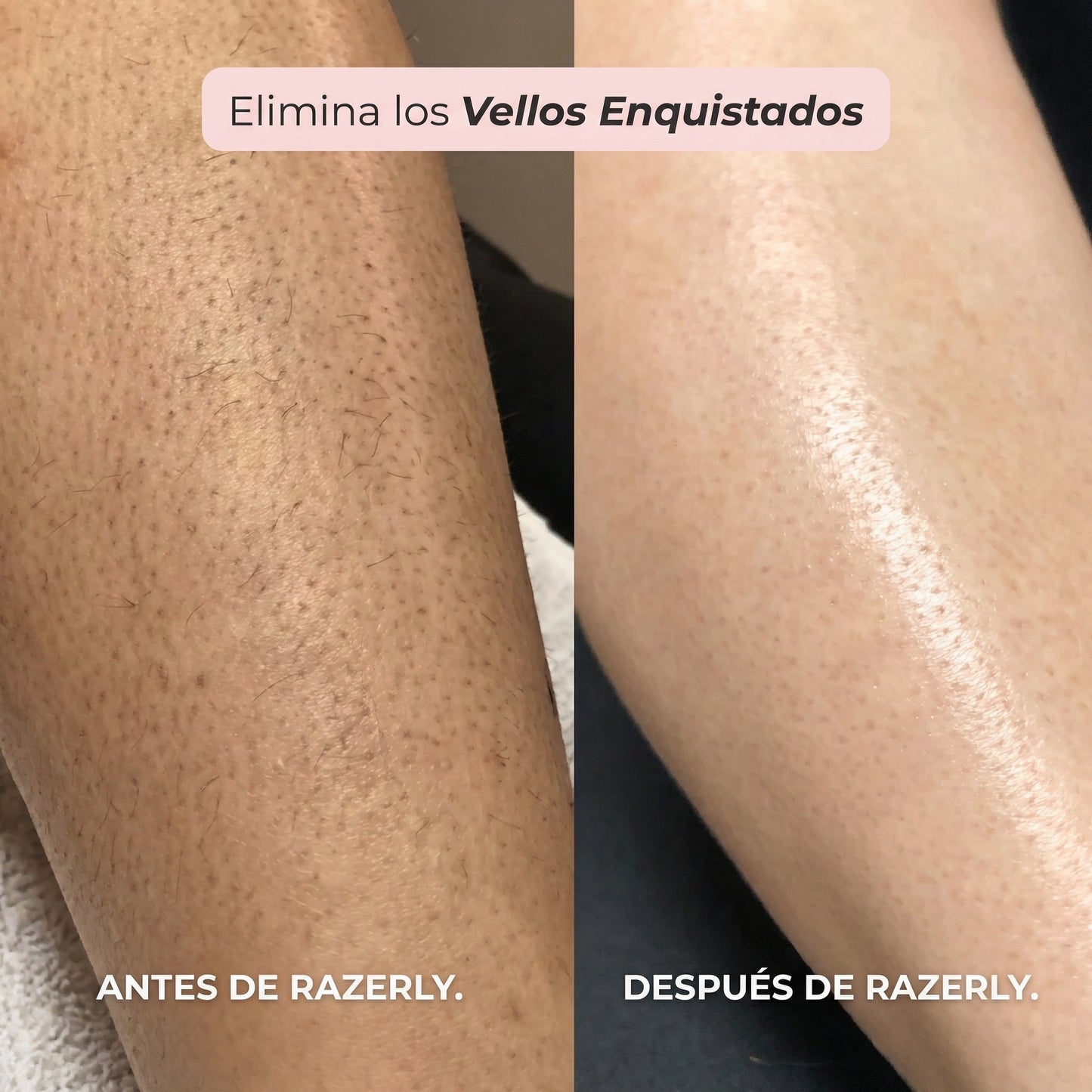 Rasoio 2 in 1 per bikini e corpo Shavea™
