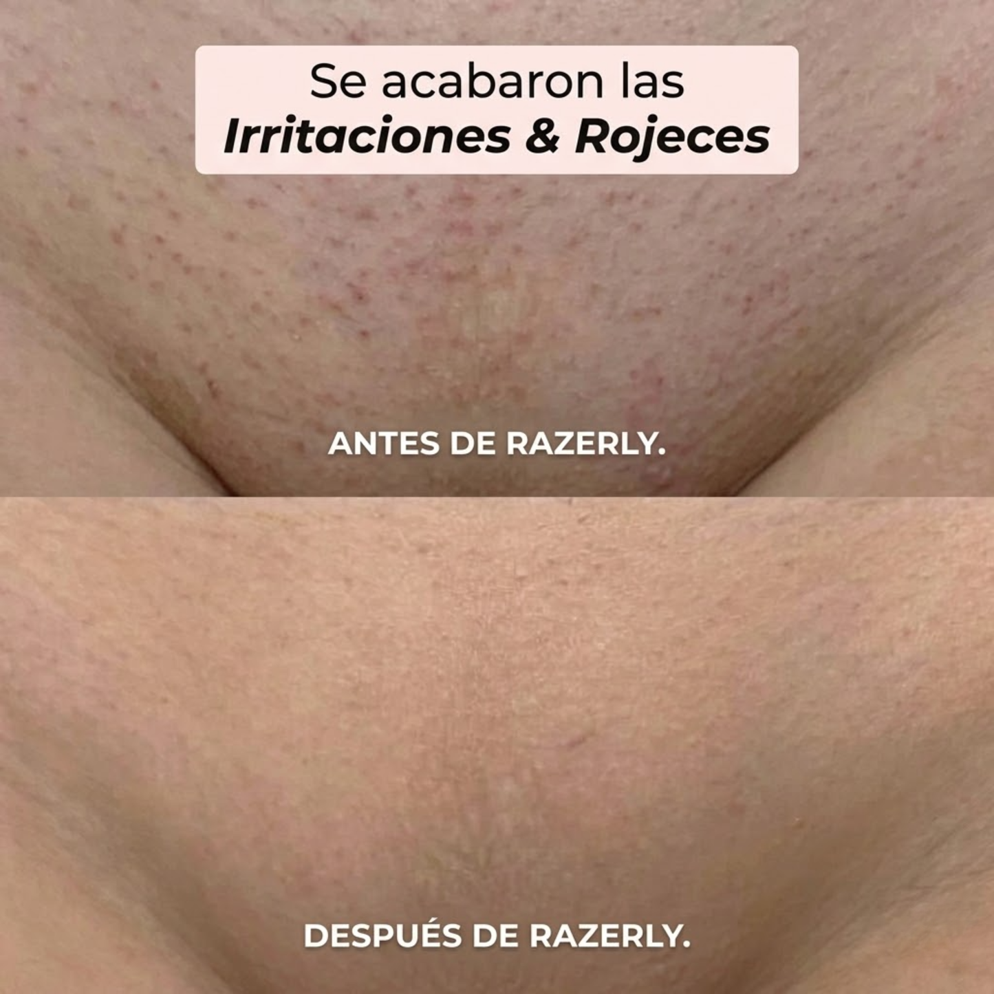 Rasoio 2 in 1 per bikini e corpo Shavea™